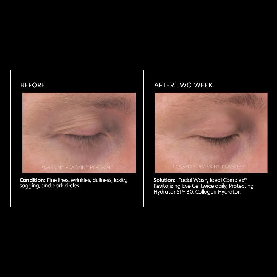 PCA Skin Ideal Complex restorative eye cream