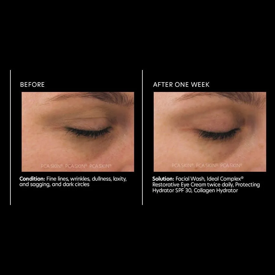 PCA Skin Ideal Complex restorative eye cream